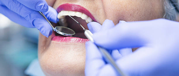 Best Mobile Emergency Dentist in Huntsville, MO